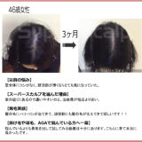 分け目の薄毛が改善【40代女性発毛症例】