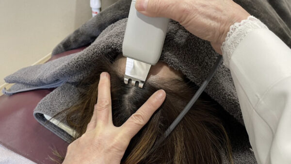 【施術紹介】頭皮環境を改善する3つの施術