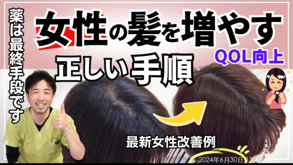 【薄毛治療】女性の薄毛対策の正しい手順とは？