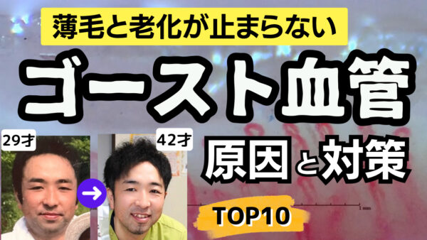 【薄毛とゴースト血管】毛細血管が消滅する生活習慣とは？