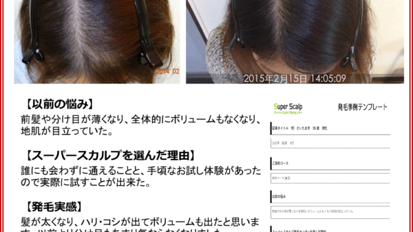 【32歳女性発毛症例】冬の頭皮ケアで分け目の薄毛が改善したお客様の実例