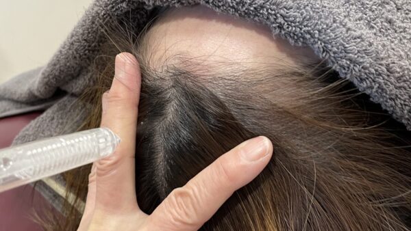 育毛サロン専門の【頭皮集中ケア】をご体感ください♪