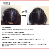 【40代女性・発毛症例】薬に頼らず3ヶ月で頭頂部のボリュームを実感｜発毛コース12回